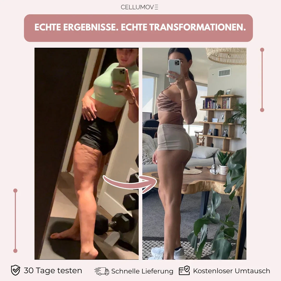 Sculpta | Anti-Cellulite Leggings